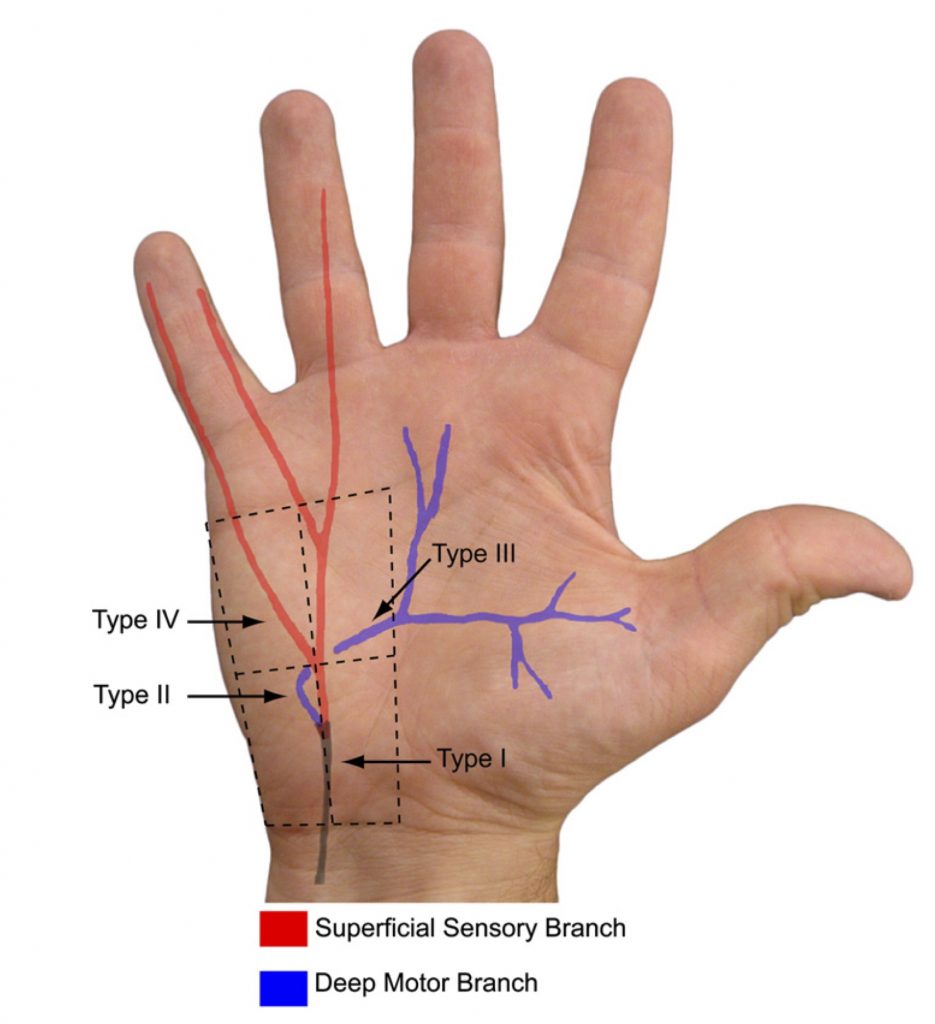 gabapentin ulnar neuropathy