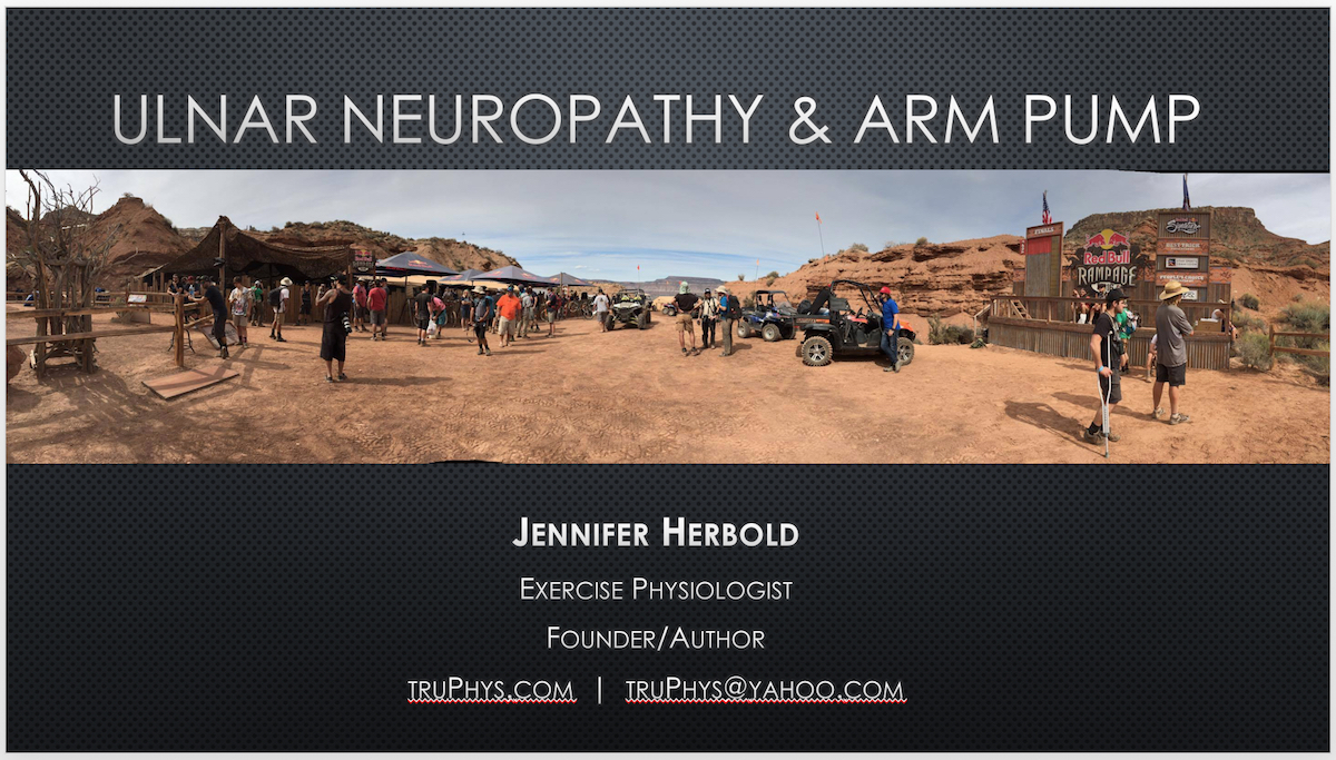 powerpoint on ulnar neuropathy