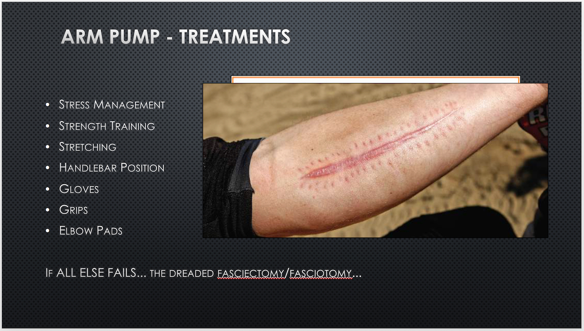 scar from fasciotomy